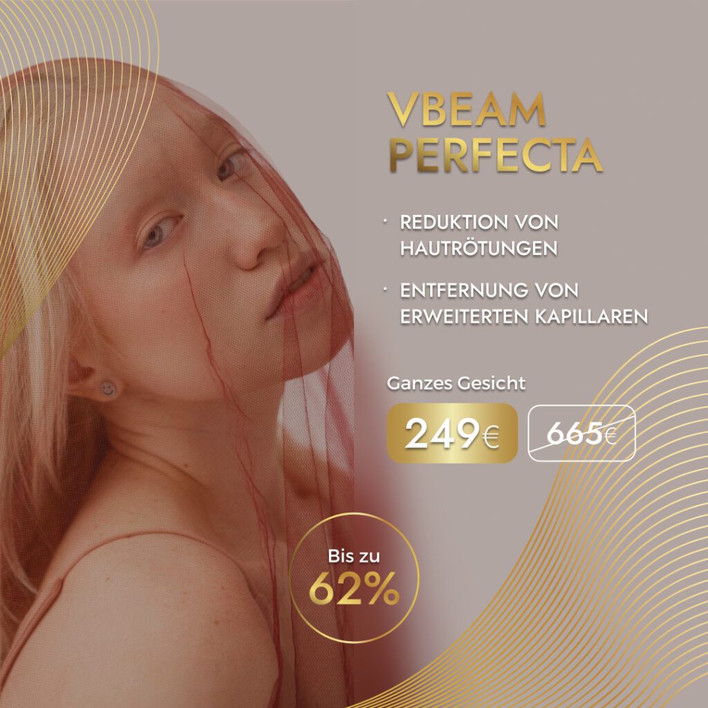 VBeam