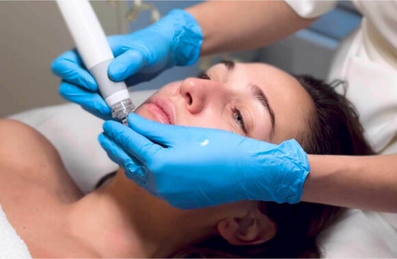 preime-dermafacial-580x0-c-default